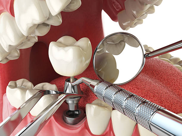 Best Emergency Gum Treatment in Lake Grove, NY
